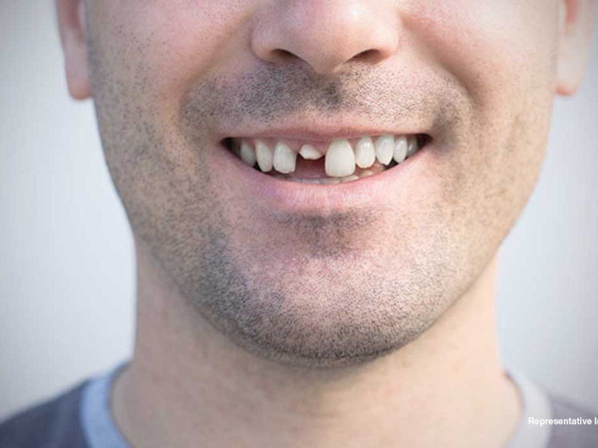 إنجاز طبي ياباني.. دواء ثوري يعيد نمو الأسنان خلال سنوات